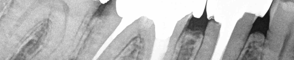 endodoncja